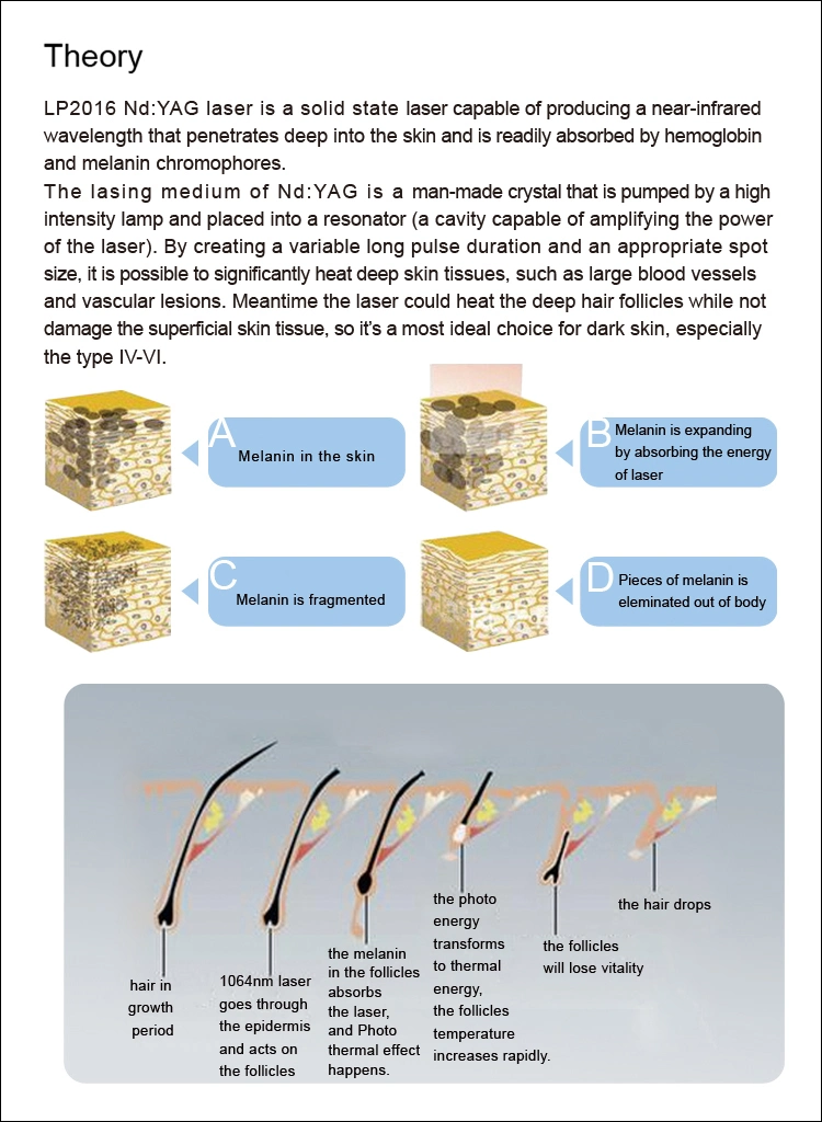 Hot ND YAG 1064 Long Pulsed Laser Hair Removal Machine Laser Pulse Machine Pulsed Dye Laser